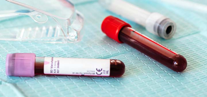 Se pueden realizar análisis de sangre para conocer los niveles de hemoglobina 